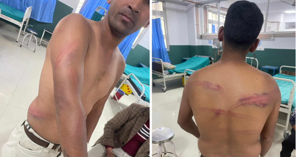 डडेल्धुरामा अमरगढी–६ का वडाध्यक्षमाथि कुटपिट,  प्रहरीमा दुवै पक्षको उजुरी